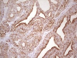 MDR1/ABCB1 Antibody (OTI1A7), Novus Biologicals 0.1mL; Unlabeled:Antibodies,