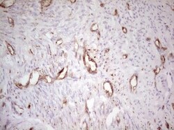 MDR1/ABCB1 Antibody (OTI1A7), Novus Biologicals 0.1mL; Unlabeled:Antibodies,