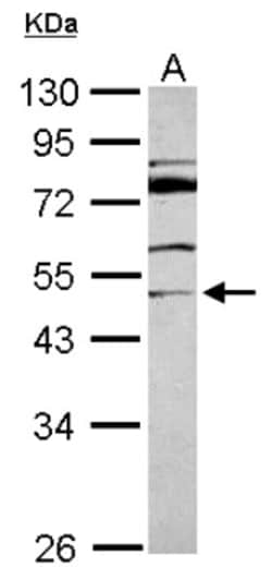 MDS028 Antibody, Novus Biologicals 0.1mL; Unlabeled:Antibodies, Polyclonal