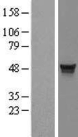 Novus Biologicals™ MDS028 Overexpression Lysate