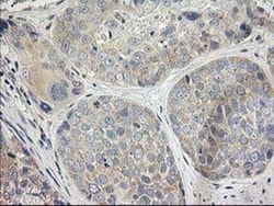 MDS028 Antibody (OTI3C4), Novus Biologicals 0.1mL; Unlabeled:Antibodies,
