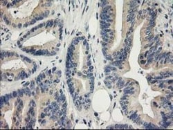 MDS028 Antibody (OTI3C4), Novus Biologicals 0.1mL; Unlabeled:Antibodies,