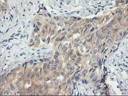 MDS028 Antibody (OTI3C4), Novus Biologicals 0.1mL; Unlabeled:Antibodies,