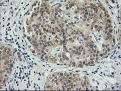 MDS028 Antibody (OTI3C4), Novus Biologicals 0.1mL; Unlabeled:Antibodies,