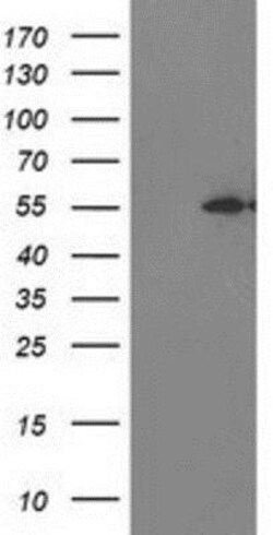 MDS028 Antibody (OTI3C4), Novus Biologicals 0.1mL; Unlabeled:Antibodies,