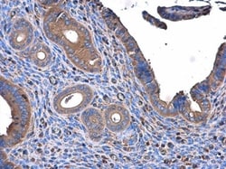 ME1 Antibody (15611), Novus Biologicals 0.1mL; Unlabeled:Antibodies, Monoclonal