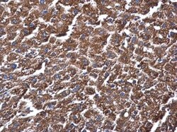 ME1 Antibody (15611), Novus Biologicals 0.1mL; Unlabeled:Antibodies, Monoclonal