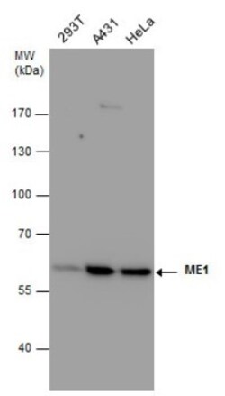 ME1 Antibody (15611), Novus Biologicals 0.1mL; Unlabeled:Antibodies, Monoclonal