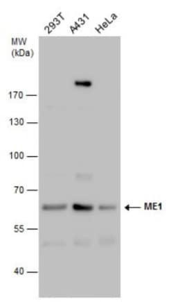 ME1 Antibody (736), Novus Biologicals 0.1mL; Unlabeled:Antibodies, Monoclonal