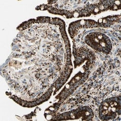 ME2 Antibody, Novus Biologicals:Antibodies:Primary Antibodies