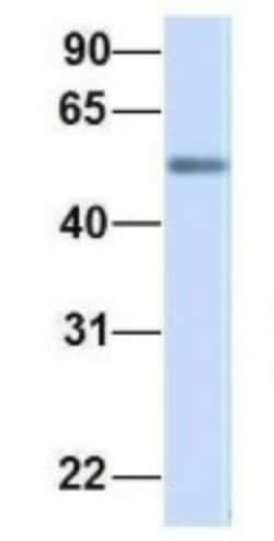 ME2 Antibody, Novus Biologicals:Antibodies:Primary Antibodies