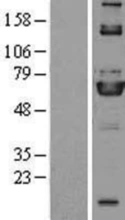 Novus Biologicals&trade;&nbsp;ME3 Overexpression Lysate