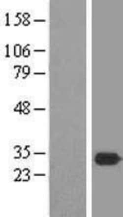 Novus Biologicals&trade;&nbsp;MEA-1 Overexpression Lysate