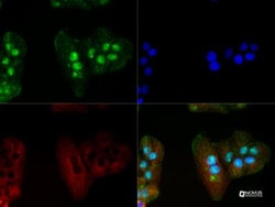 MeCP2 Antibody, Novus Biologicals 0.1mg; Unlabeled:Antibodies, Polyclonal