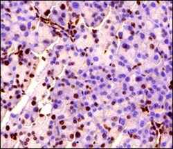 MeCP2 Antibody, Novus Biologicals 0.1mg; Unlabeled:Antibodies, Polyclonal