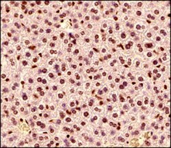 MeCP2 Antibody, Novus Biologicals 0.1mg; Unlabeled:Antibodies, Polyclonal