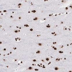MeCP2 Antibody, Novus Biologicals 0.1mL; Unlabeled:Antibodies, Polyclonal