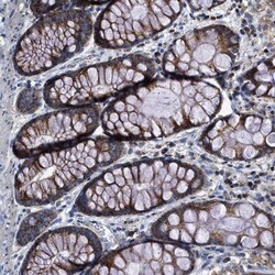 MECR Antibody, Novus Biologicals 25 &mu;L; Unlabeled:Antibodies, Polyclonal