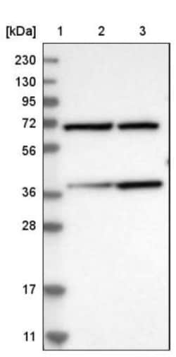 MECR Antibody, Novus Biologicals 25 &mu;L; Unlabeled:Antibodies, Polyclonal