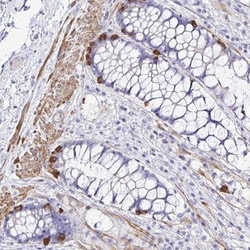 MED11 Antibody, Novus Biologicals 0.1mL; Unlabeled:Antibodies, Polyclonal