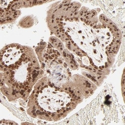 MED15 Antibody, Novus Biologicals 0.1mL; Unlabeled:Antibodies, Polyclonal