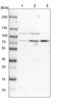 MED15 Antibody, Novus Biologicals 0.1mL; Unlabeled:Antibodies, Polyclonal