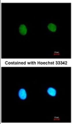 MED18 Antibody, Novus Biologicals 0.1mL; Unlabeled:Antibodies, Polyclonal