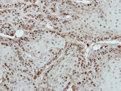 MED18 Antibody, Novus Biologicals 0.1mL; Unlabeled:Antibodies, Polyclonal