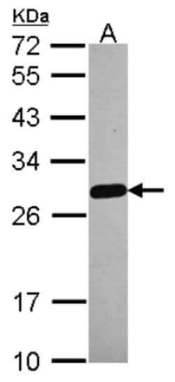 MED18 Antibody, Novus Biologicals 0.1mL; Unlabeled:Antibodies, Polyclonal