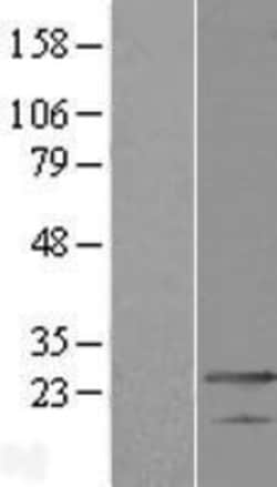 Novus Biologicals&trade;&nbsp;MED19 Overexpression Lysate