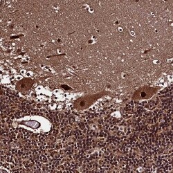MED19 Antibody, Novus Biologicals:Antibodies:Primary Antibodies