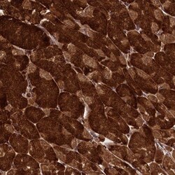 MED19 Antibody, Novus Biologicals 0.1mL; Unlabeled:Antibodies, Polyclonal