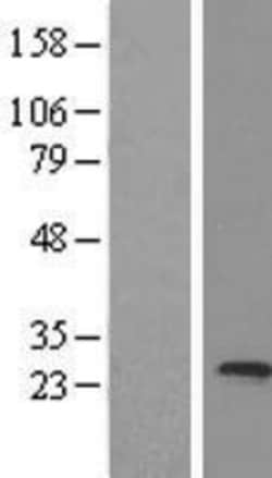 Novus Biologicals™ MED20 Overexpression Lysate