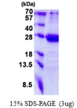 Novus Biologicals&trade;&nbsp;Recombinant Human MED20 His Protein