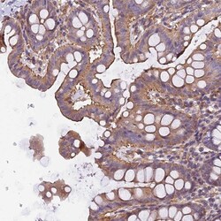 MED20 Antibody, Novus Biologicals:Antibodies:Primary Antibodies