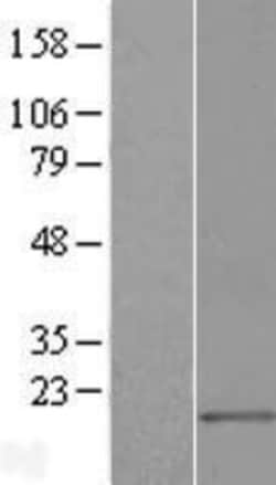 Novus Biologicals™ MED21 Overexpression Lysate