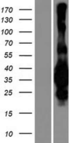 Novus Biologicals&trade;&nbsp;MED29 Overexpression Lysate