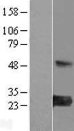 Novus Biologicals™ MED30 Overexpression Lysate
