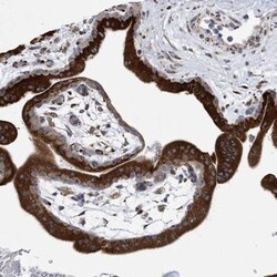 MED31 Antibody, Novus Biologicals 25 &mu;L; Unlabeled:Antibodies, Polyclonal