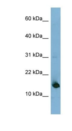 MED31 Antibody, Novus Biologicals:Antibodies:Primary Antibodies