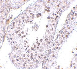 MED4 Antibody - BSA Free, Novus Biologicals 0.1mg; Unlabeled:Antibodies,