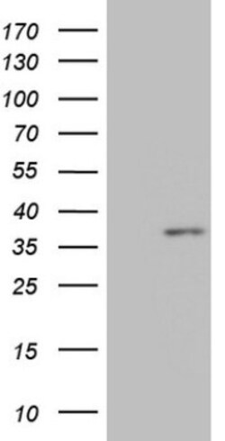 MED6 Antibody (OTI3C9), Novus Biologicals 0.1 mL | Buy Online | Novus Biologicals | Fisher Scientific