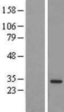 Novus Biologicals&trade;&nbsp;MED6 Overexpression Lysate