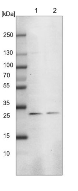 MED8 Antibody, Novus Biologicals:Antibodies:Primary Antibodies