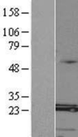 Novus Biologicals&trade;&nbsp;MED8 Overexpression Lysate