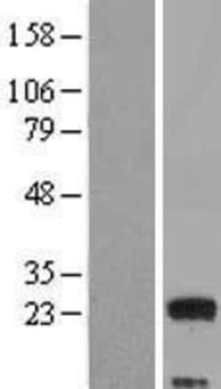 Novus Biologicals&trade;&nbsp;MED9 Overexpression Lysate