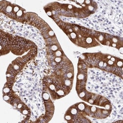 MED9 Antibody, Novus Biologicals:Antibodies:Primary Antibodies