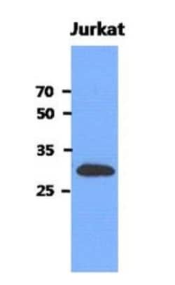 mediator of cell motility 1 Antibody (1E9) - BSA Free, Novus Biologicals