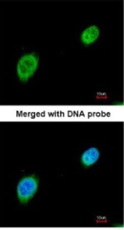 MEF2A Antibody, Novus Biologicals 0.1mL; Unlabeled:Antibodies, Polyclonal