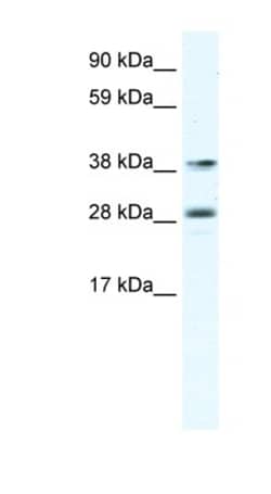 MEF2B Antibody, Novus Biologicals:Antibodies:Primary Antibodies